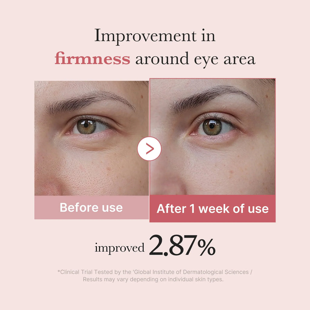 Medicube PDRN Pink Peptide Eye Cream – Contorno reafirmante con péptidos (30 ml)