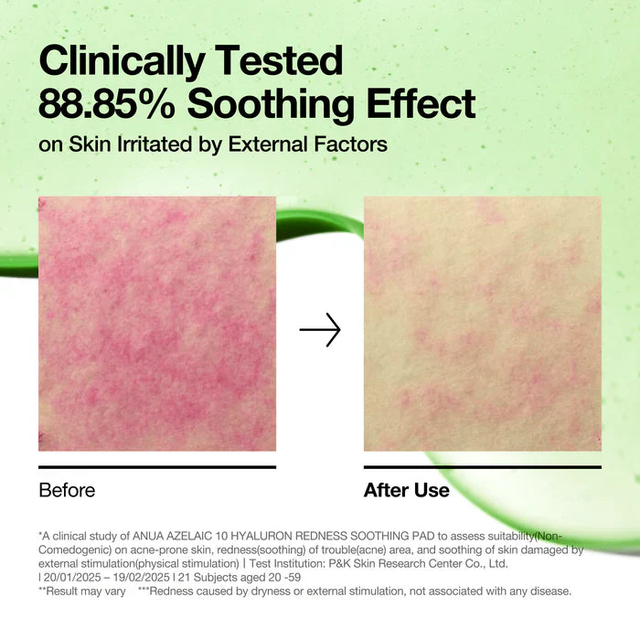 Anua Pads calmantes – Ácido azelaico 10 % + Ácido hialurónico (90 pads)